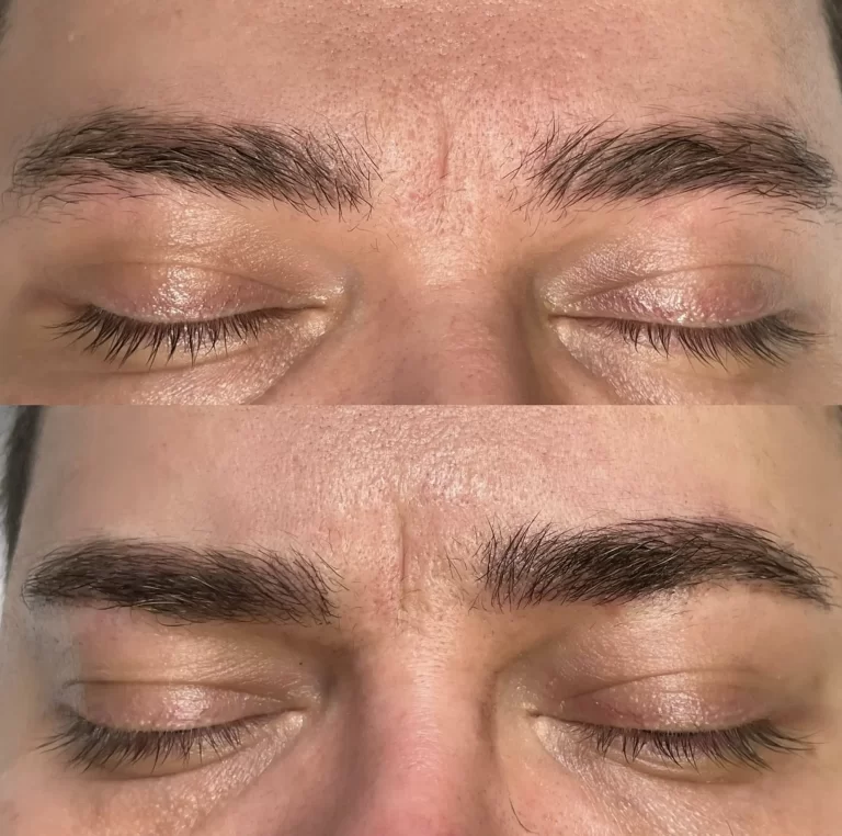 Microblading for Men: Why More Guys Are Choosing This Treatment