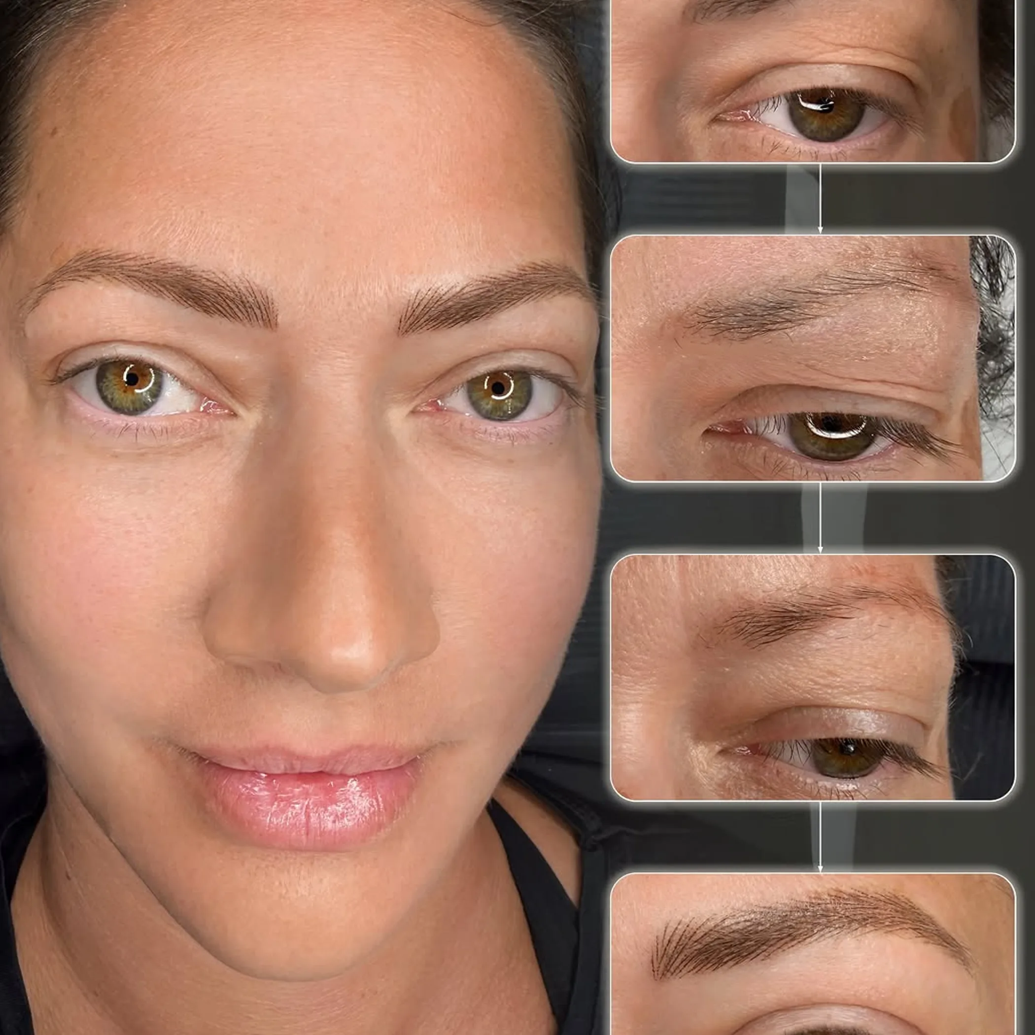 close-up of eyebrow before and after tattoo removal